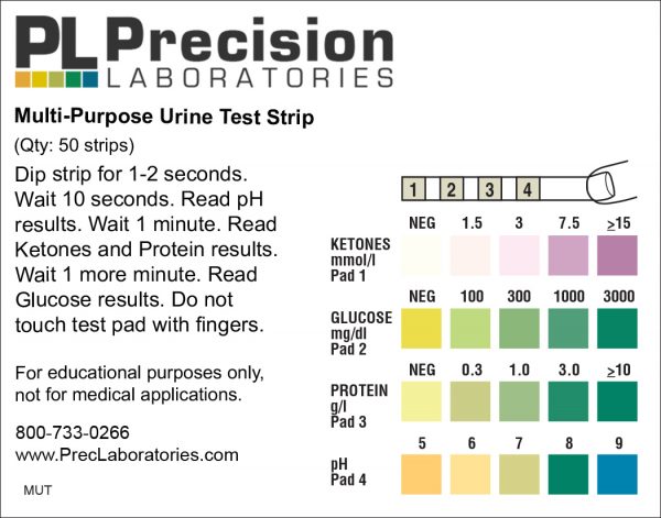 Urine Analysis Test Strip